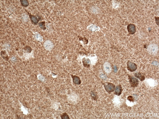 TTL Antibody in Immunohistochemistry (Paraffin) (IHC (P))