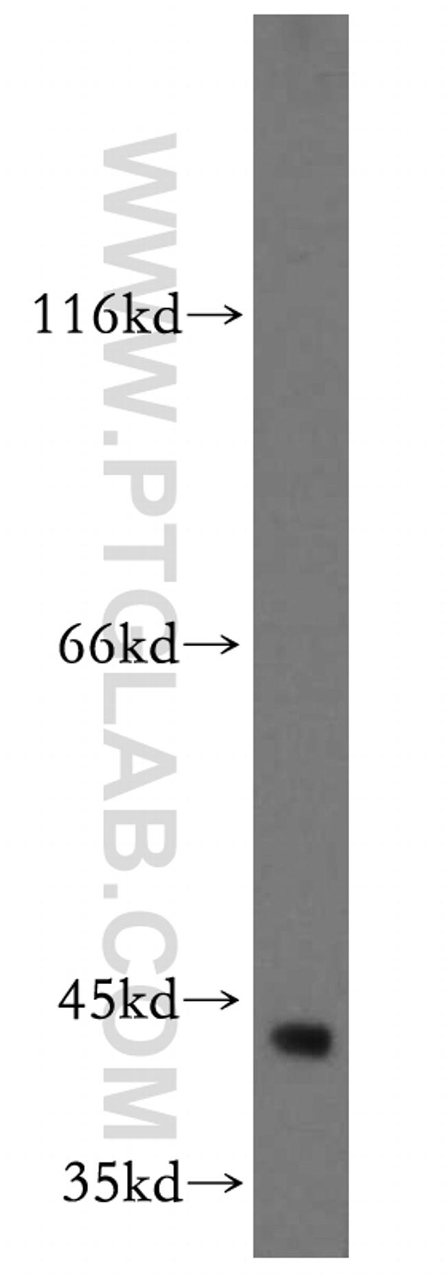 TTL Antibody in Western Blot (WB)