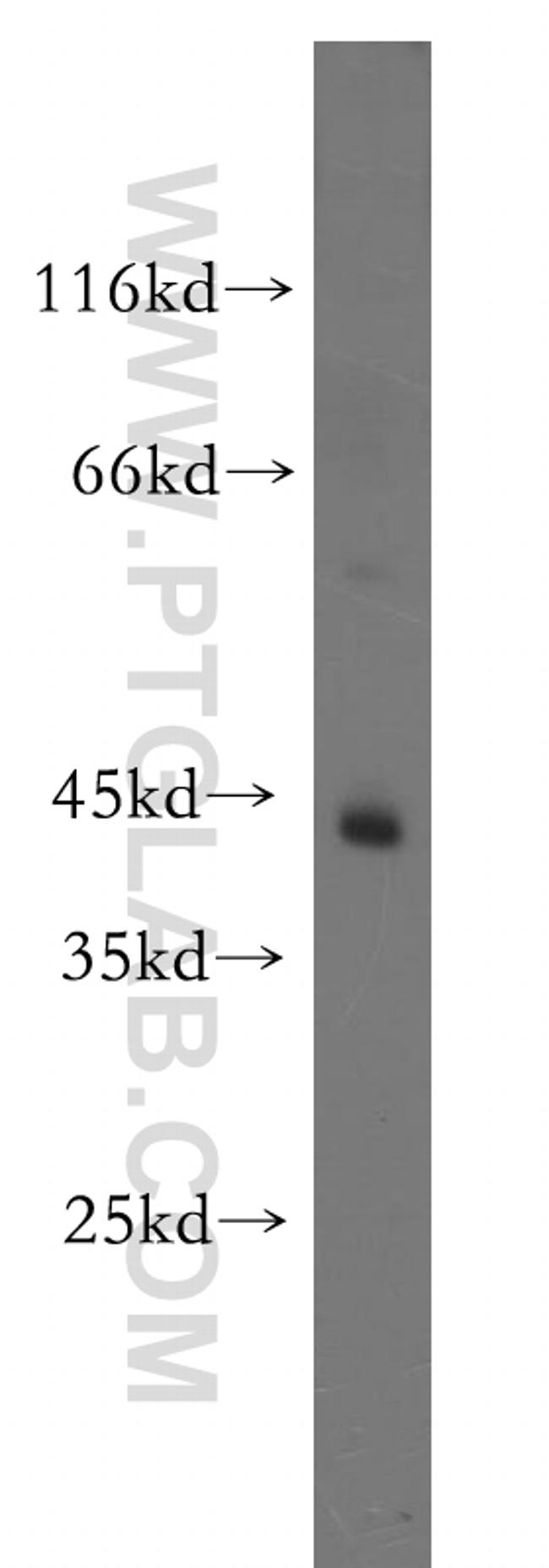 TTL Antibody in Western Blot (WB)