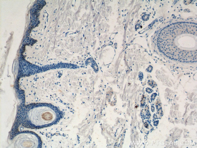 ST3GAL2 Antibody in Immunohistochemistry (Paraffin) (IHC (P))