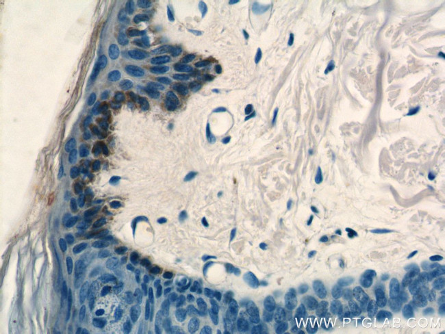 ST3GAL2 Antibody in Immunohistochemistry (Paraffin) (IHC (P))