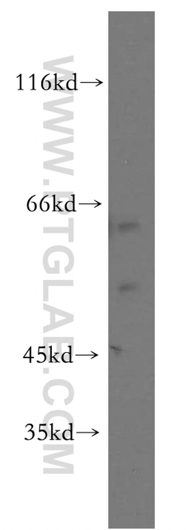 ST3GAL2 Antibody in Western Blot (WB)