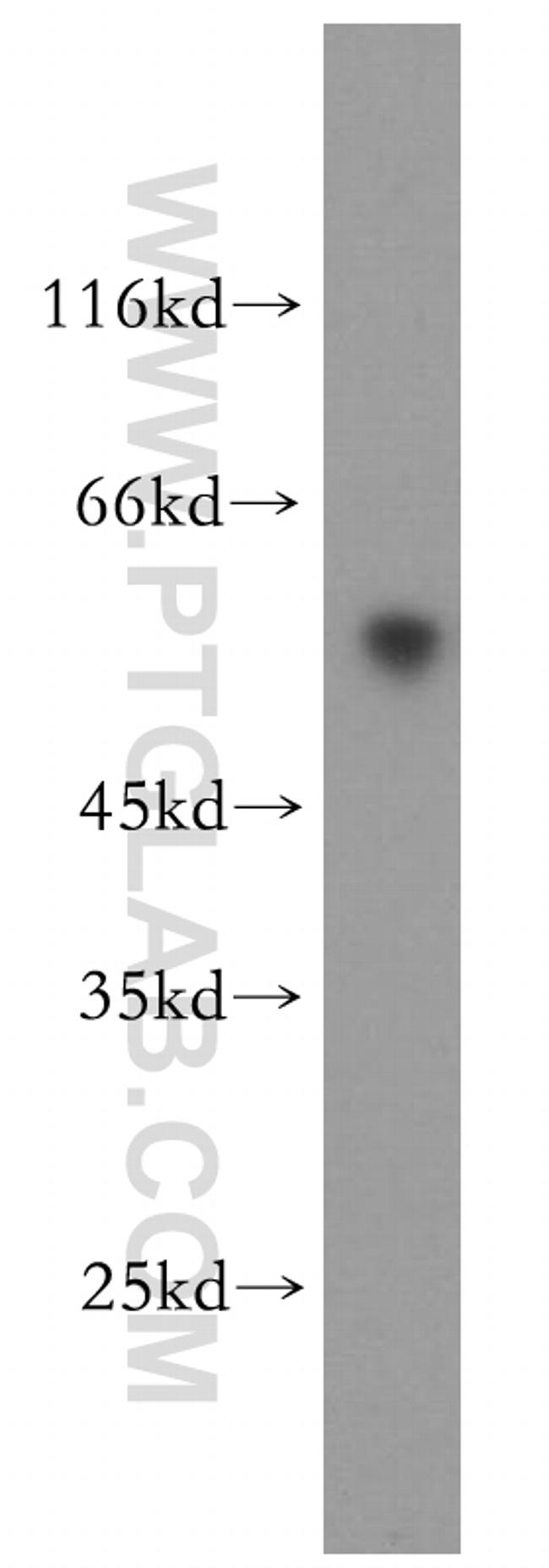 ST3GAL2 Antibody in Western Blot (WB)