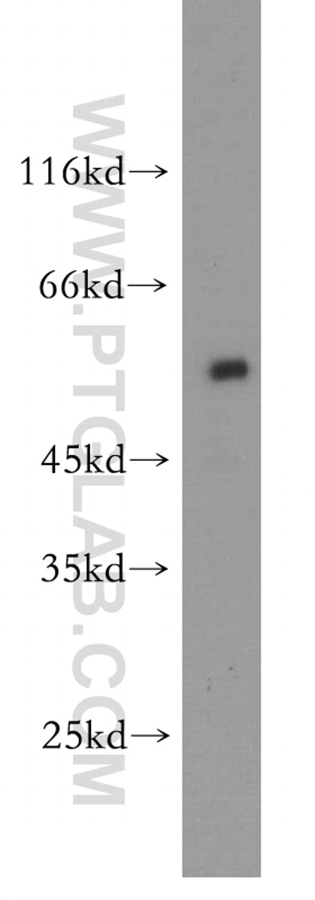 ST3GAL2 Antibody in Western Blot (WB)