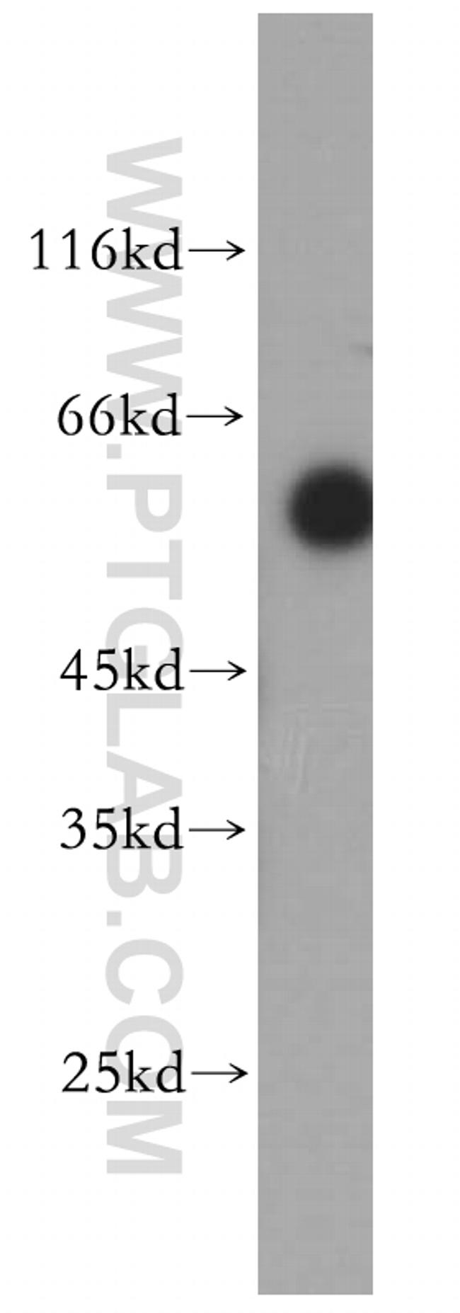 ST3GAL2 Antibody in Western Blot (WB)