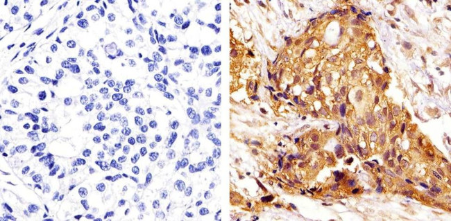 ERK1/ERK2 Antibody in Immunohistochemistry (Paraffin) (IHC (P))