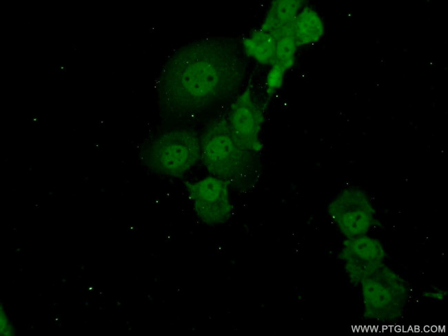 ADAT2 Antibody in Immunocytochemistry (ICC/IF)