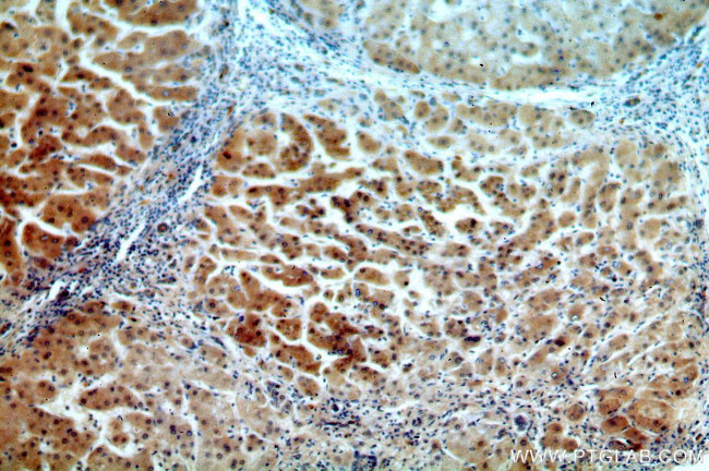 ADAT2 Antibody in Immunohistochemistry (Paraffin) (IHC (P))