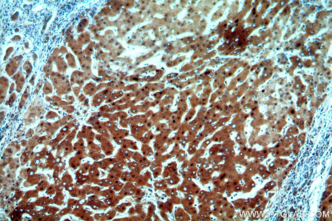 ADAT2 Antibody in Immunohistochemistry (Paraffin) (IHC (P))