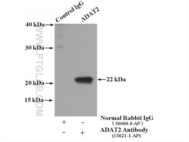 ADAT2 Antibody in Immunoprecipitation (IP)