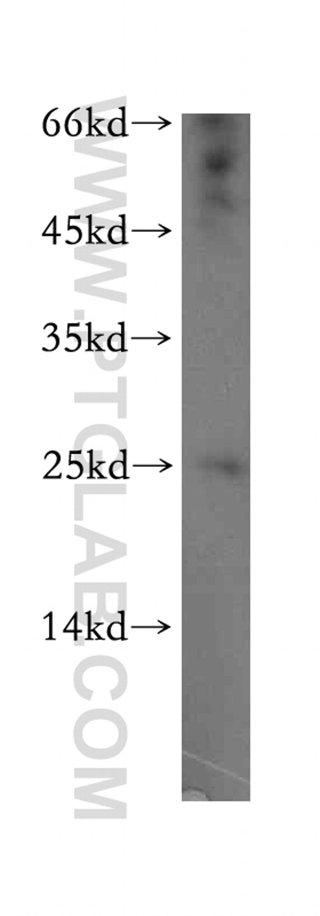 ADAT2 Antibody in Western Blot (WB)