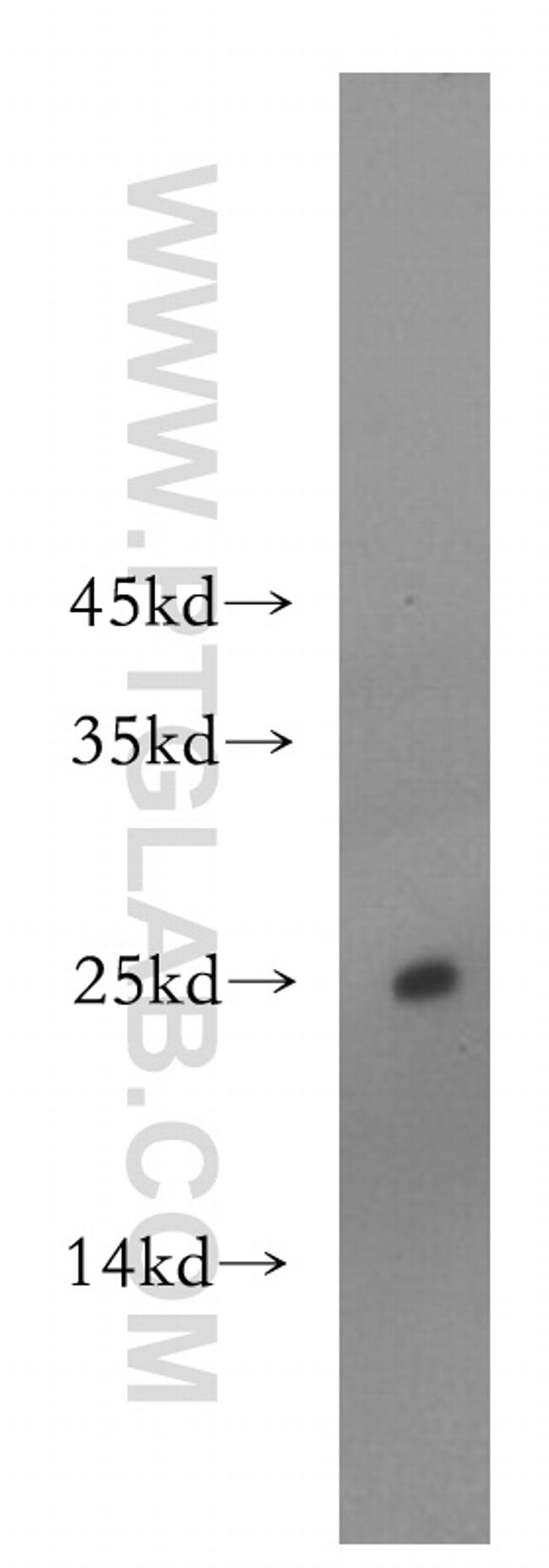 ADAT2 Antibody in Western Blot (WB)