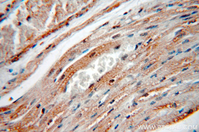 KCNH7 Antibody in Immunohistochemistry (Paraffin) (IHC (P))