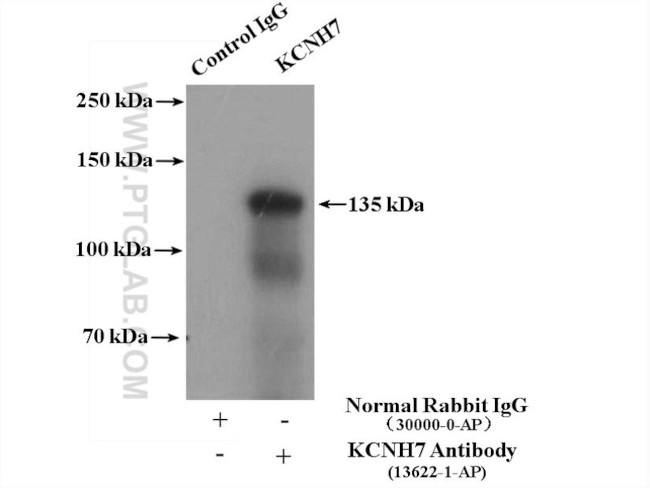 KCNH7 Antibody in Immunoprecipitation (IP)