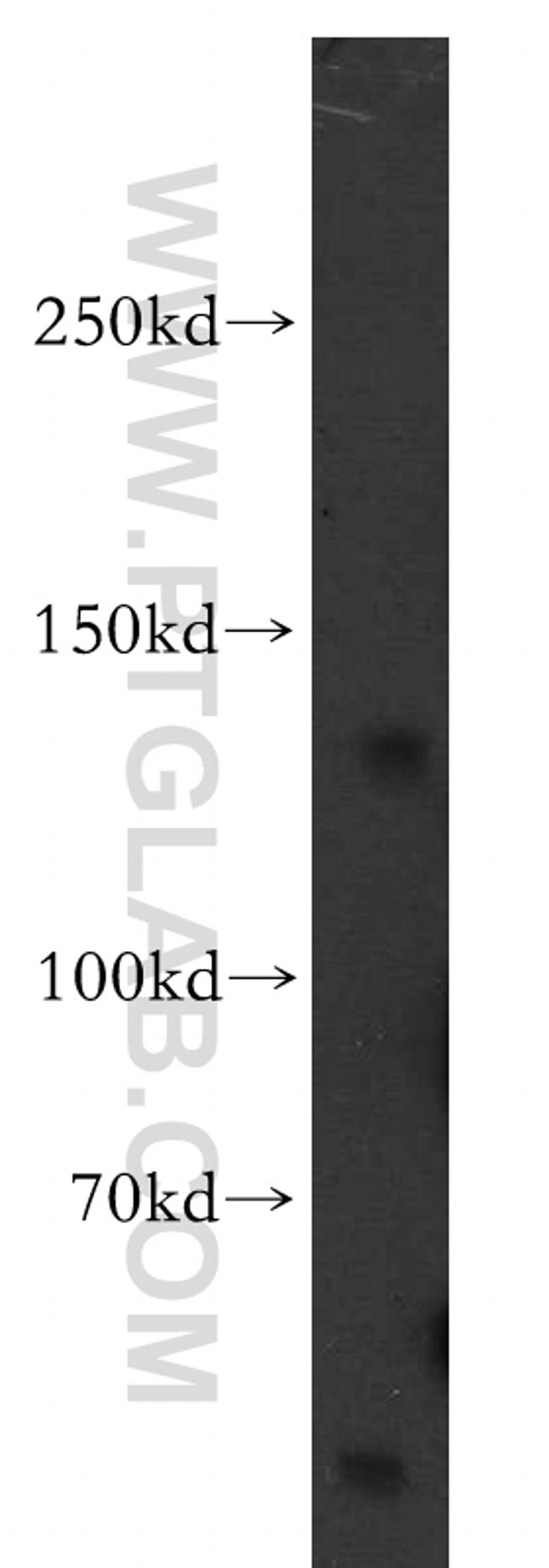 KCNH7 Antibody in Western Blot (WB)