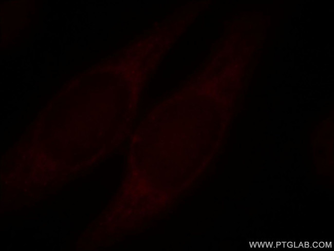 TRIM15 Antibody in Immunocytochemistry (ICC/IF)