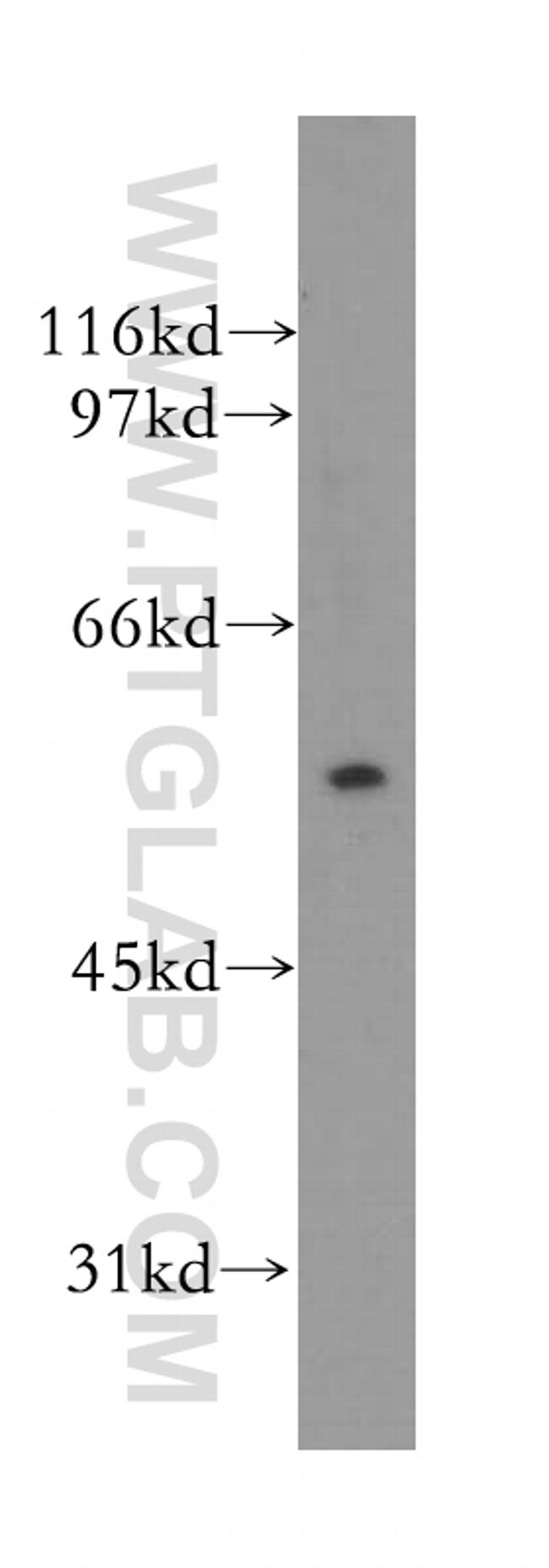 TRIM15 Antibody in Western Blot (WB)