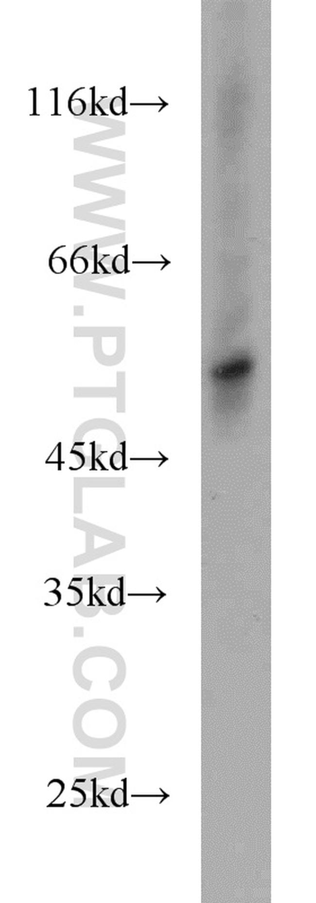 TRIM15 Antibody in Western Blot (WB)