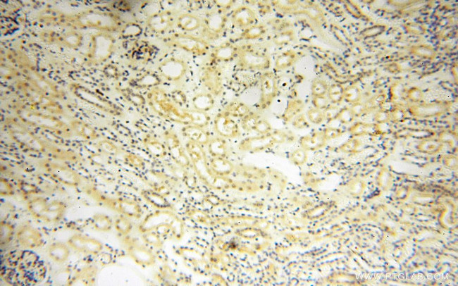 GMFG Antibody in Immunohistochemistry (Paraffin) (IHC (P))