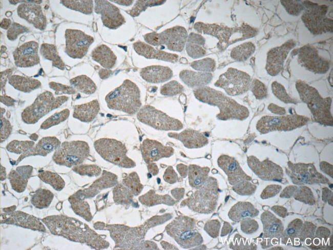 GMFG Antibody in Immunohistochemistry (Paraffin) (IHC (P))