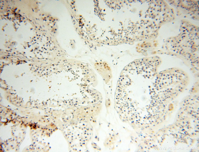 GMFG Antibody in Immunohistochemistry (Paraffin) (IHC (P))