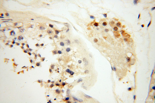 GMFG Antibody in Immunohistochemistry (Paraffin) (IHC (P))