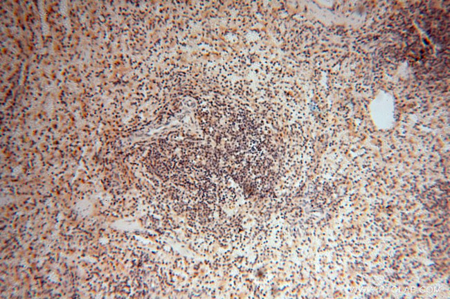 GMFG Antibody in Immunohistochemistry (Paraffin) (IHC (P))