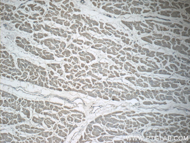 GMFG Antibody in Immunohistochemistry (Paraffin) (IHC (P))