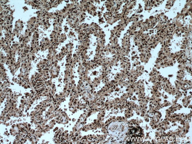 GMFG Antibody in Immunohistochemistry (Paraffin) (IHC (P))