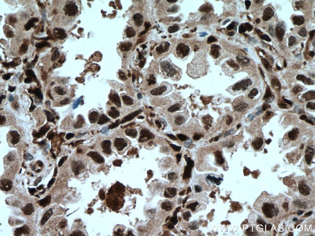 GMFG Antibody in Immunohistochemistry (Paraffin) (IHC (P))