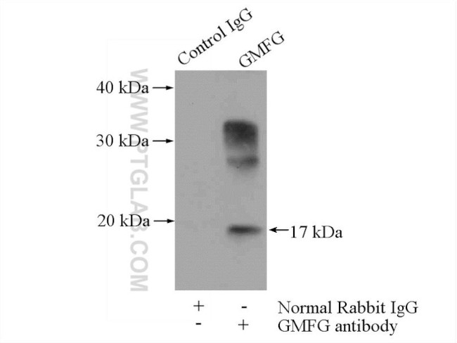 GMFG Antibody in Immunoprecipitation (IP)