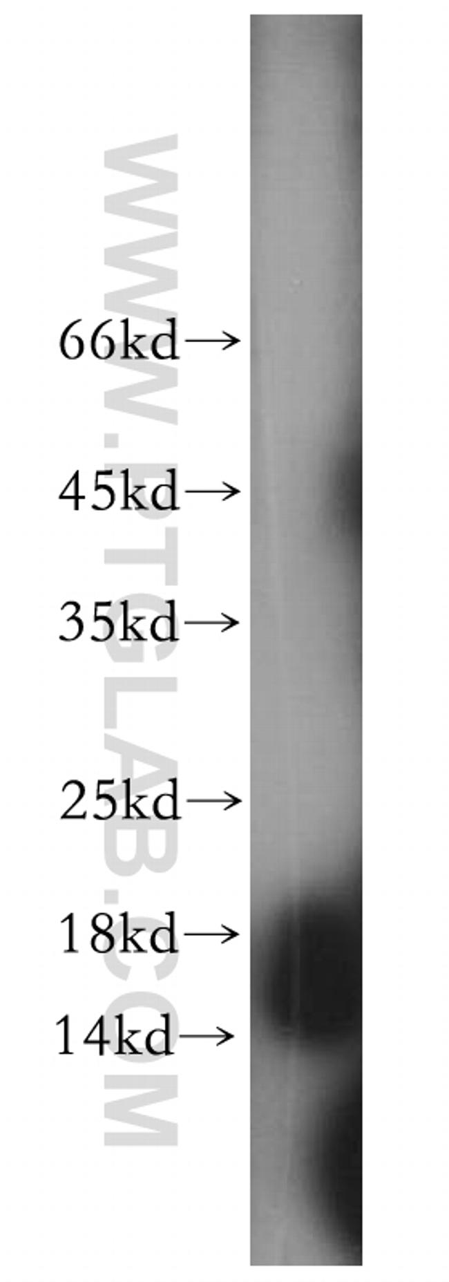 GMFG Antibody in Western Blot (WB)