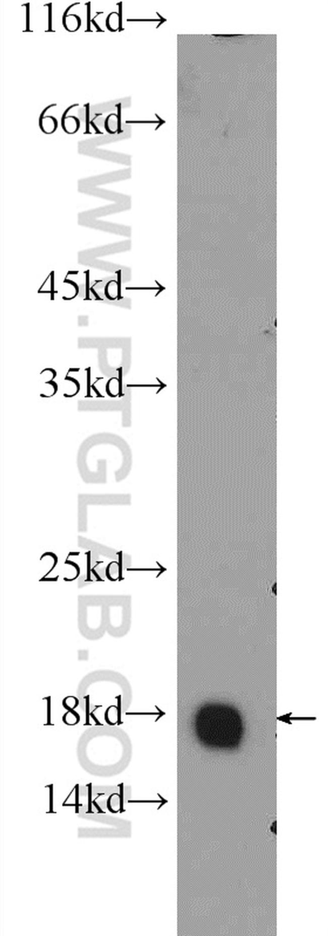 GMFG Antibody in Western Blot (WB)