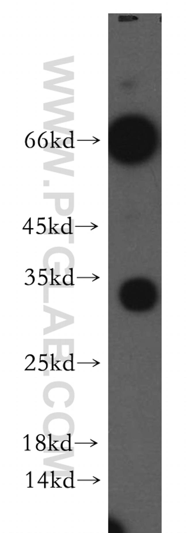 NSMCE2 Antibody in Western Blot (WB)