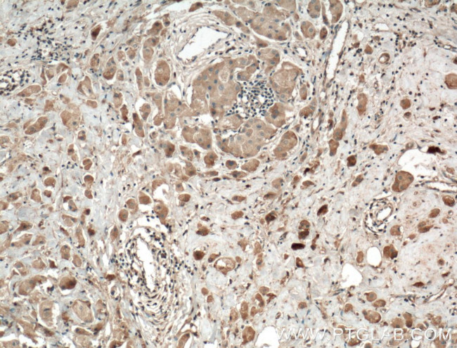 RALA Antibody in Immunohistochemistry (Paraffin) (IHC (P))