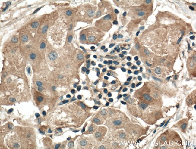 RALA Antibody in Immunohistochemistry (Paraffin) (IHC (P))