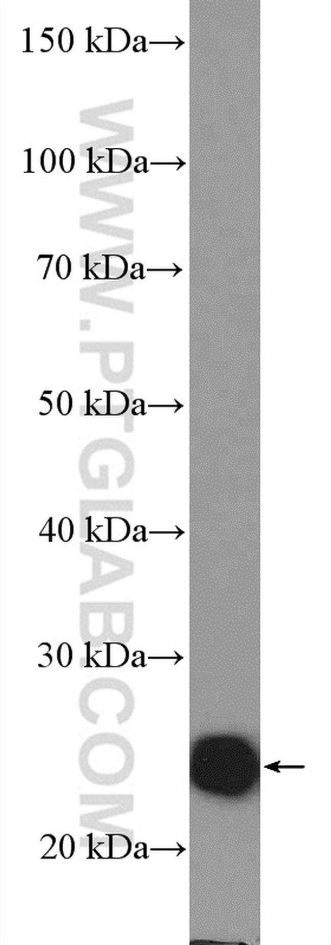 RALA Antibody in Western Blot (WB)