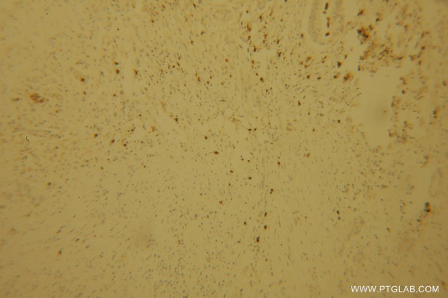 POLI Antibody in Immunohistochemistry (Paraffin) (IHC (P))