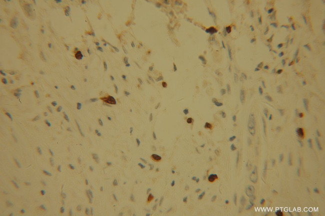 POLI Antibody in Immunohistochemistry (Paraffin) (IHC (P))