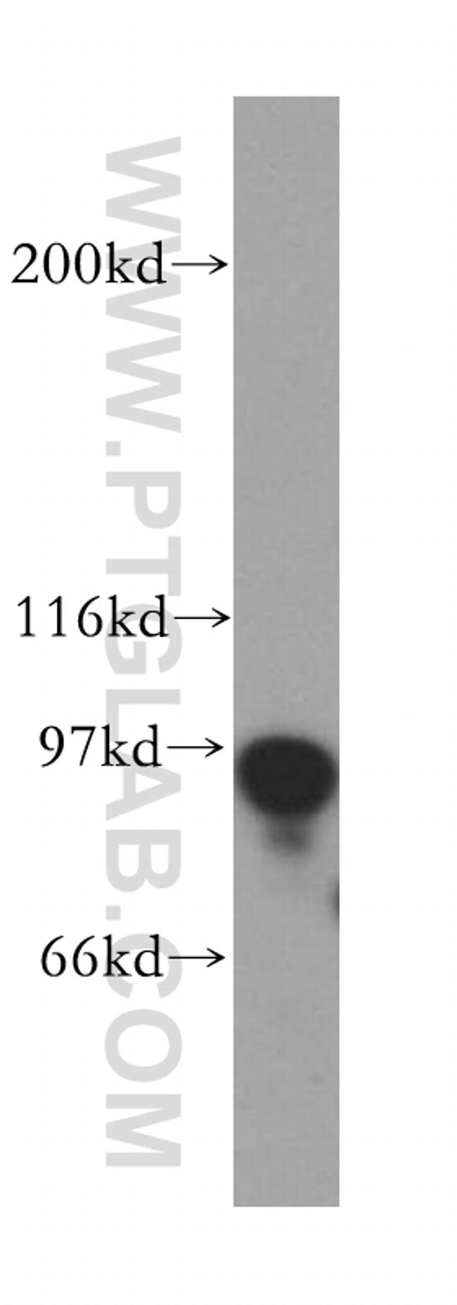 POLI Antibody in Western Blot (WB)