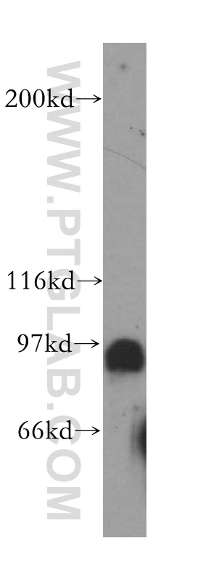 POLI Antibody in Western Blot (WB)