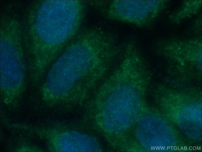 TULP3 Antibody in Immunocytochemistry (ICC/IF)