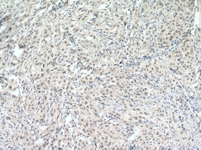 DSS1 Antibody in Immunohistochemistry (Paraffin) (IHC (P))