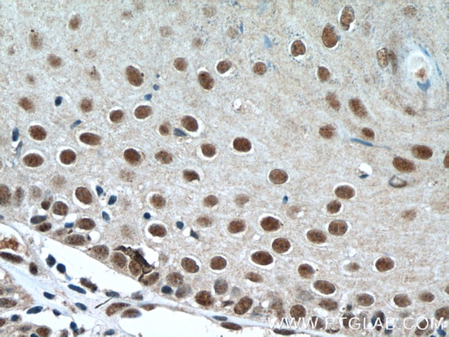 DSS1 Antibody in Immunohistochemistry (Paraffin) (IHC (P))