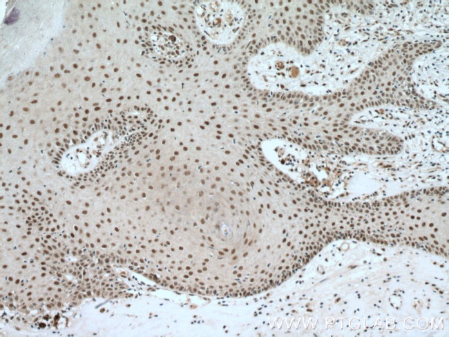 DSS1 Antibody in Immunohistochemistry (Paraffin) (IHC (P))