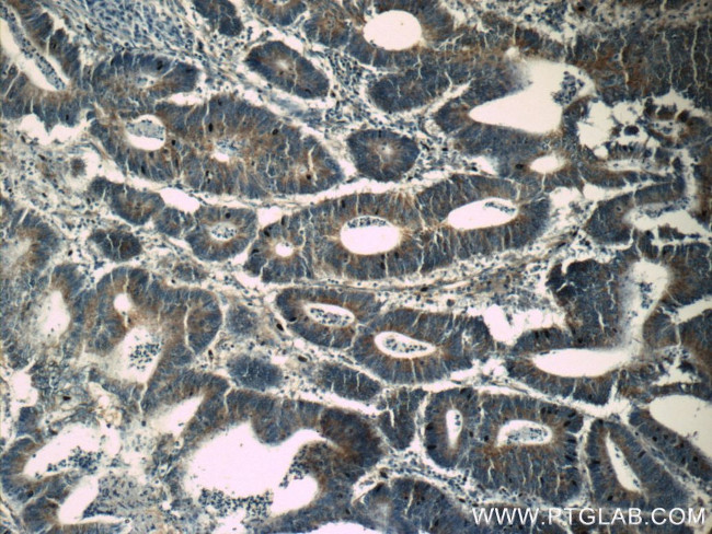 BCAT1/ECA39 Antibody in Immunohistochemistry (Paraffin) (IHC (P))