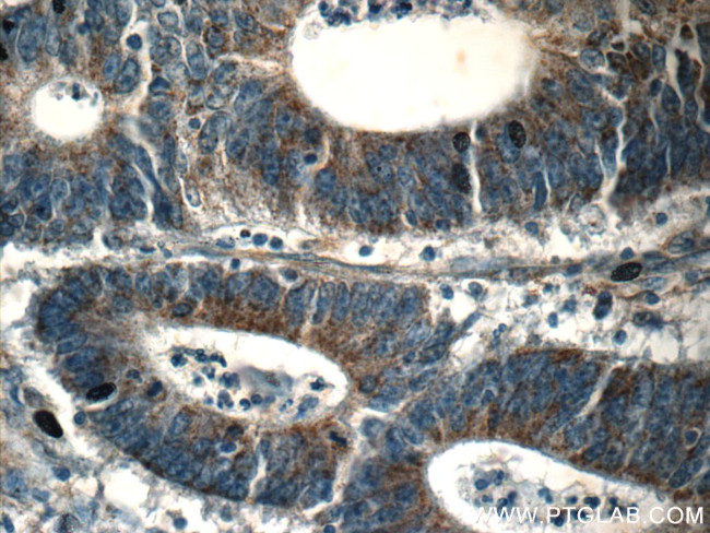 BCAT1/ECA39 Antibody in Immunohistochemistry (Paraffin) (IHC (P))