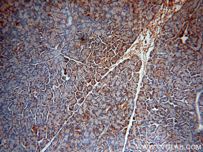 BCAT1/ECA39 Antibody in Immunohistochemistry (Paraffin) (IHC (P))