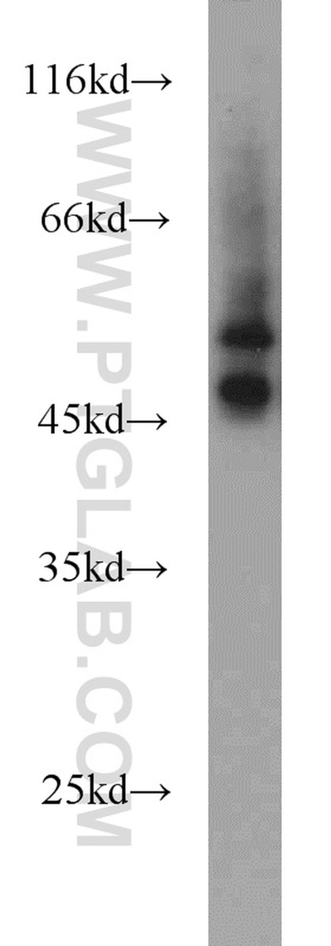 BCAT1/ECA39 Antibody in Western Blot (WB)