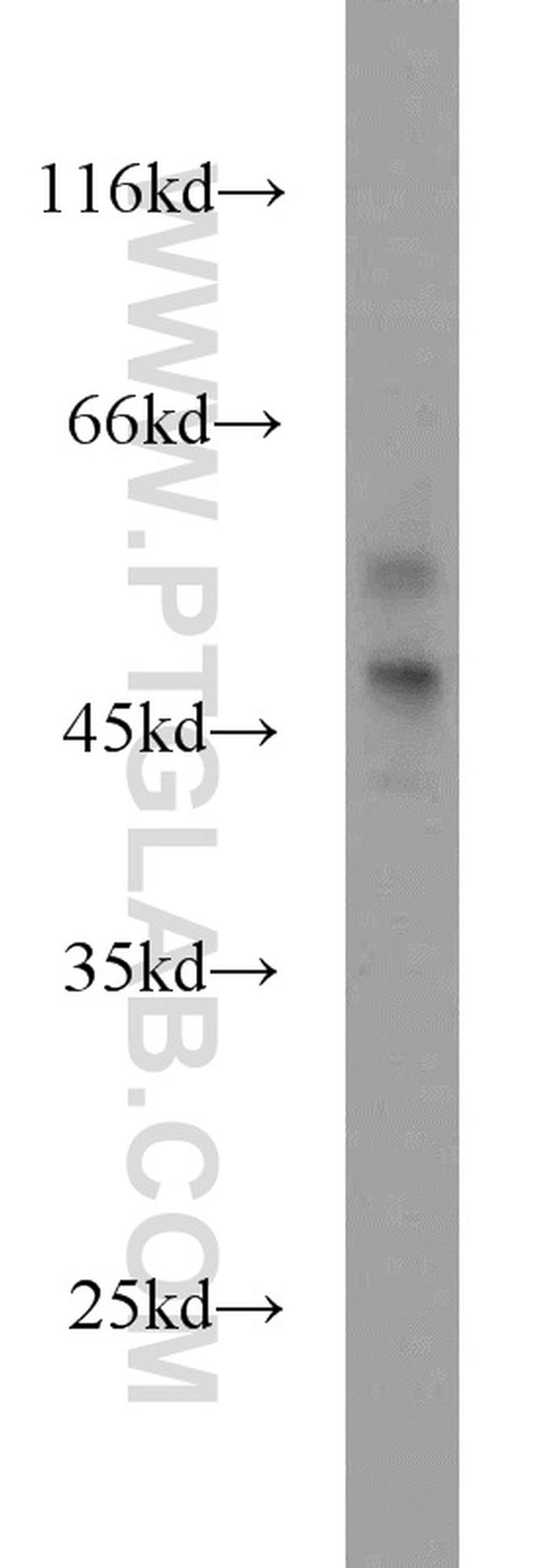 BCAT1/ECA39 Antibody in Western Blot (WB)